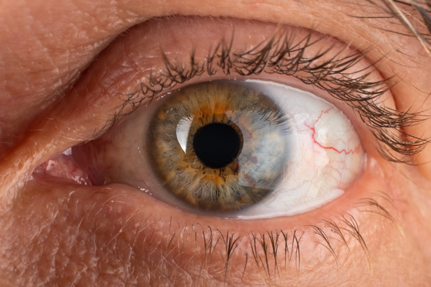 difetti visivi cosa causa l'astigmatismo